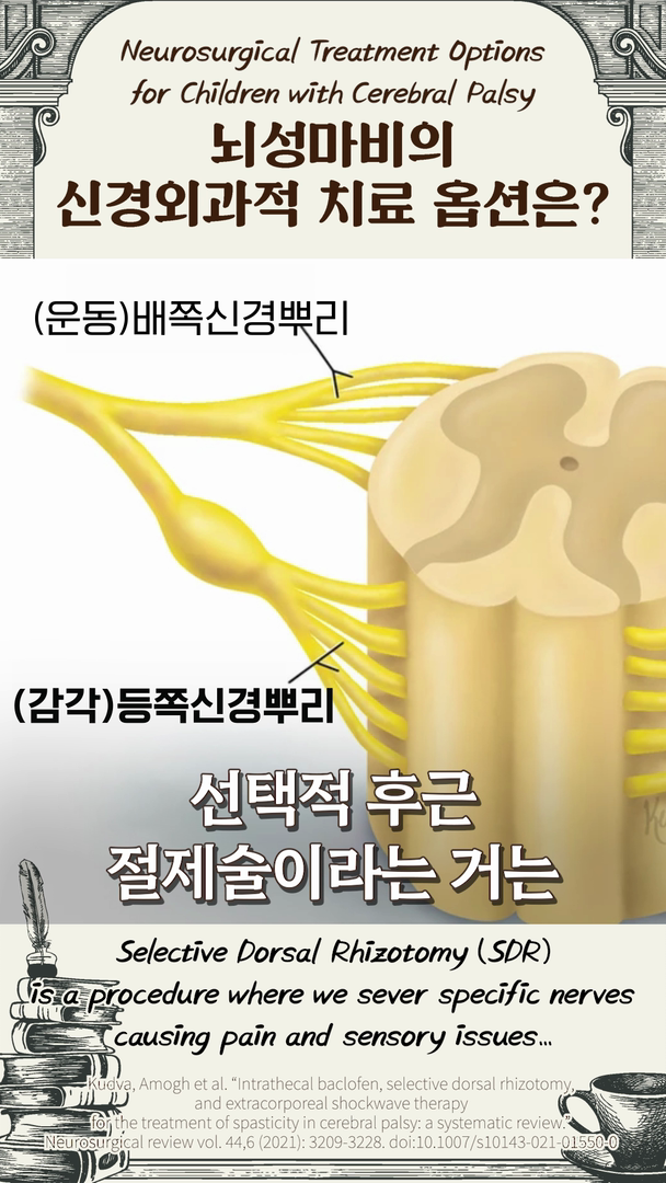 뇌성마비에 적용 가능한 신경외과적 치료 옵션은?